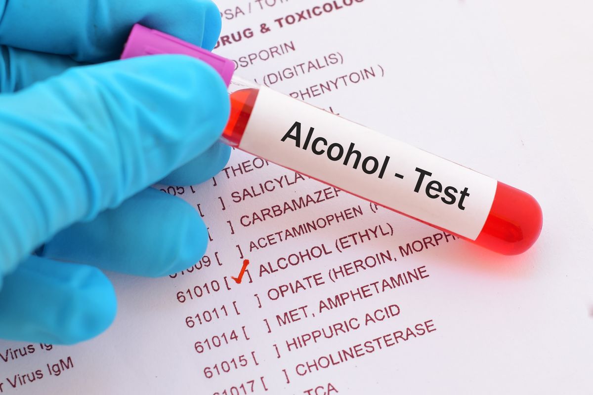 alcohol test tasso alcolemico